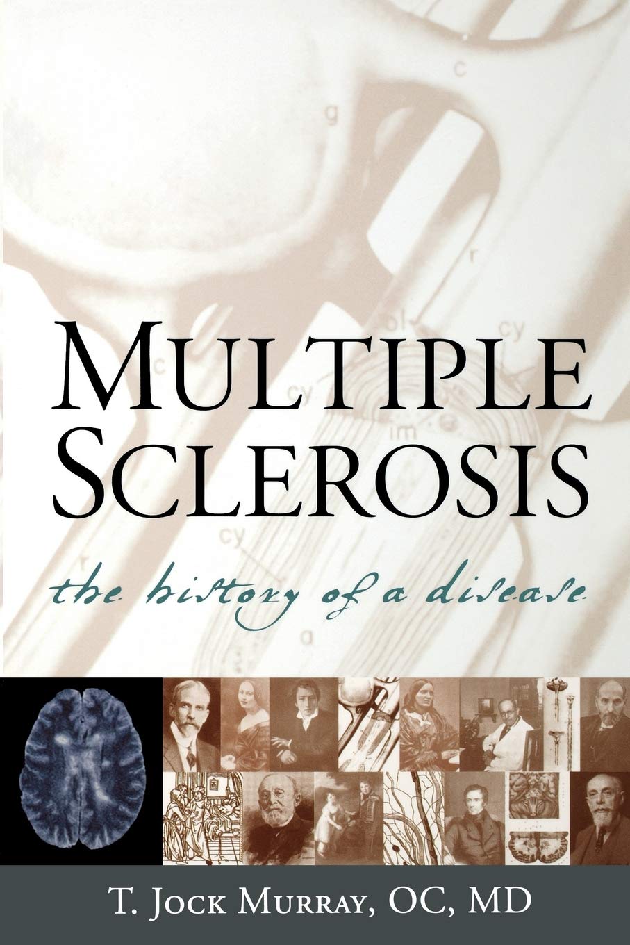 Multiple Sclerosis: The History Of A Disease