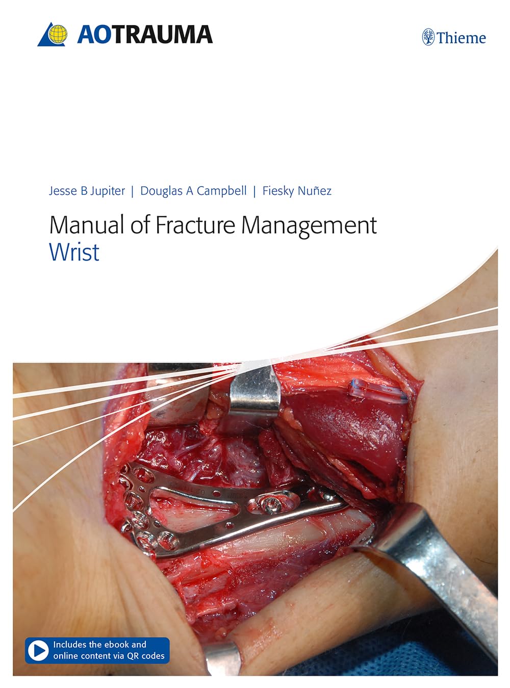 AO TRAUMA MANUAL OF FRACTURE MANAGEMENT WRIST (HB 2019)