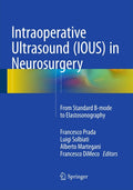 Intraoperative Ultrasound (IOUS) in Neurosurgery: From Standard Bmode to Elastosonography