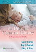 The Difficult Cesarean Delivery Safeguards And Pitfalls