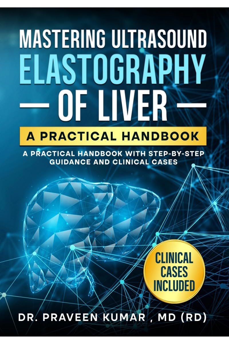 Mastering Ultrasound Elastography Of Liver: A Practical Handbook