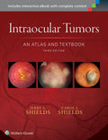 Intraocular Tumors An Atlas And Textbook 3Ed (Hb 2016)