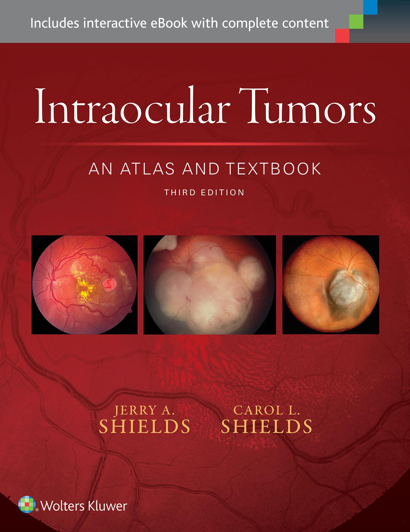 Intraocular Tumors An Atlas And Textbook 3Ed (Hb 2016)