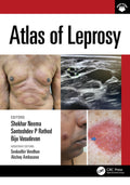 Atlas Of Leprosy (Pb 2025)