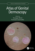 ATLAS OF GENITAL DERMOSCOPY (HB 2022) (Series in Dermatological Treatment)