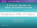 Visual Guide To Ecg Interpretation: The Essentials And More