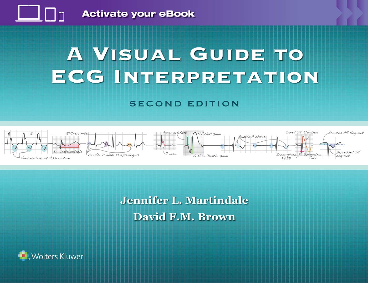 Visual Guide To Ecg Interpretation: The Essentials And More