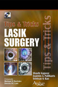 Lasik Surgery Tips & Tricks