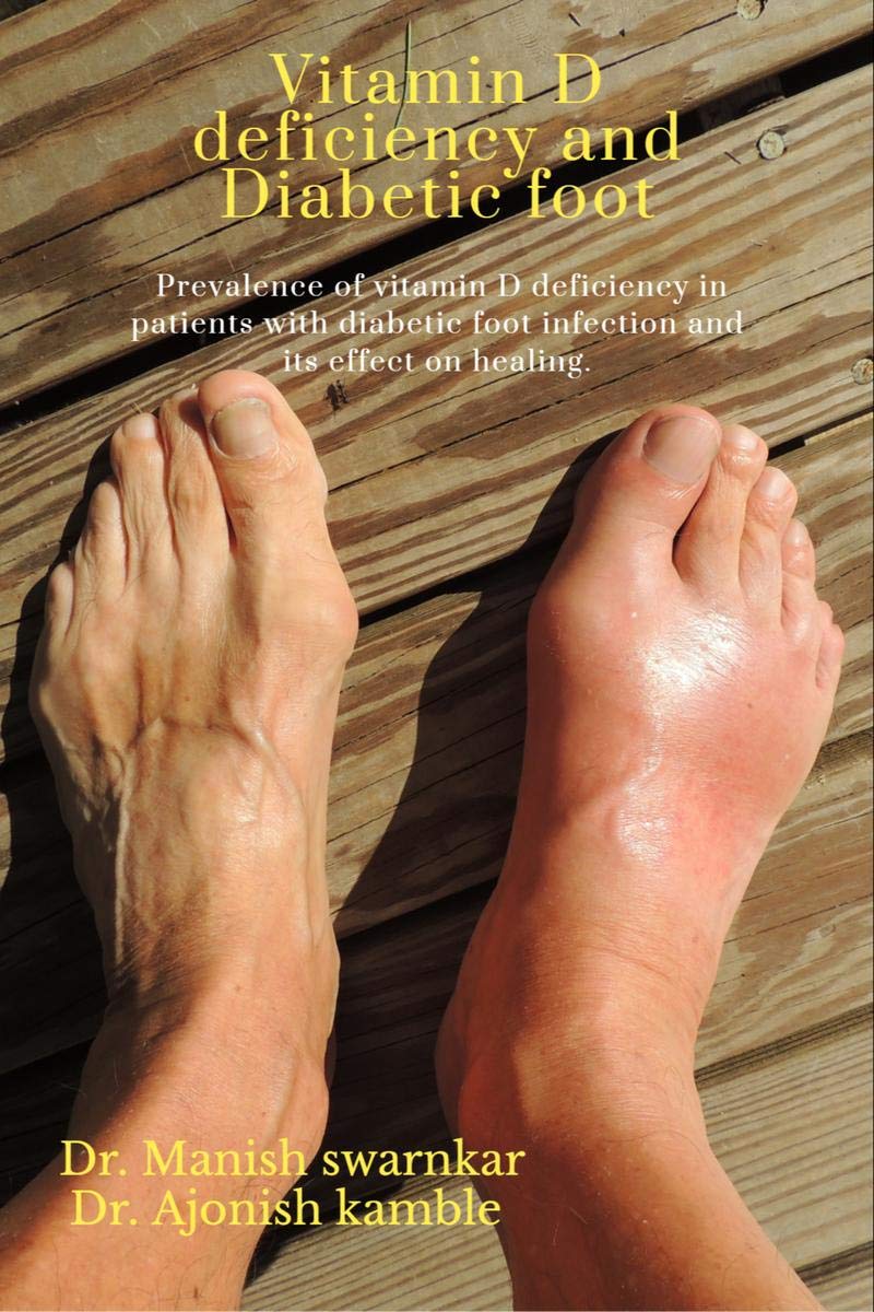 Prevalence of vitamin D deficiency in patients with diabetic foot infection and its effect on healing. : vitamin D deficiency in