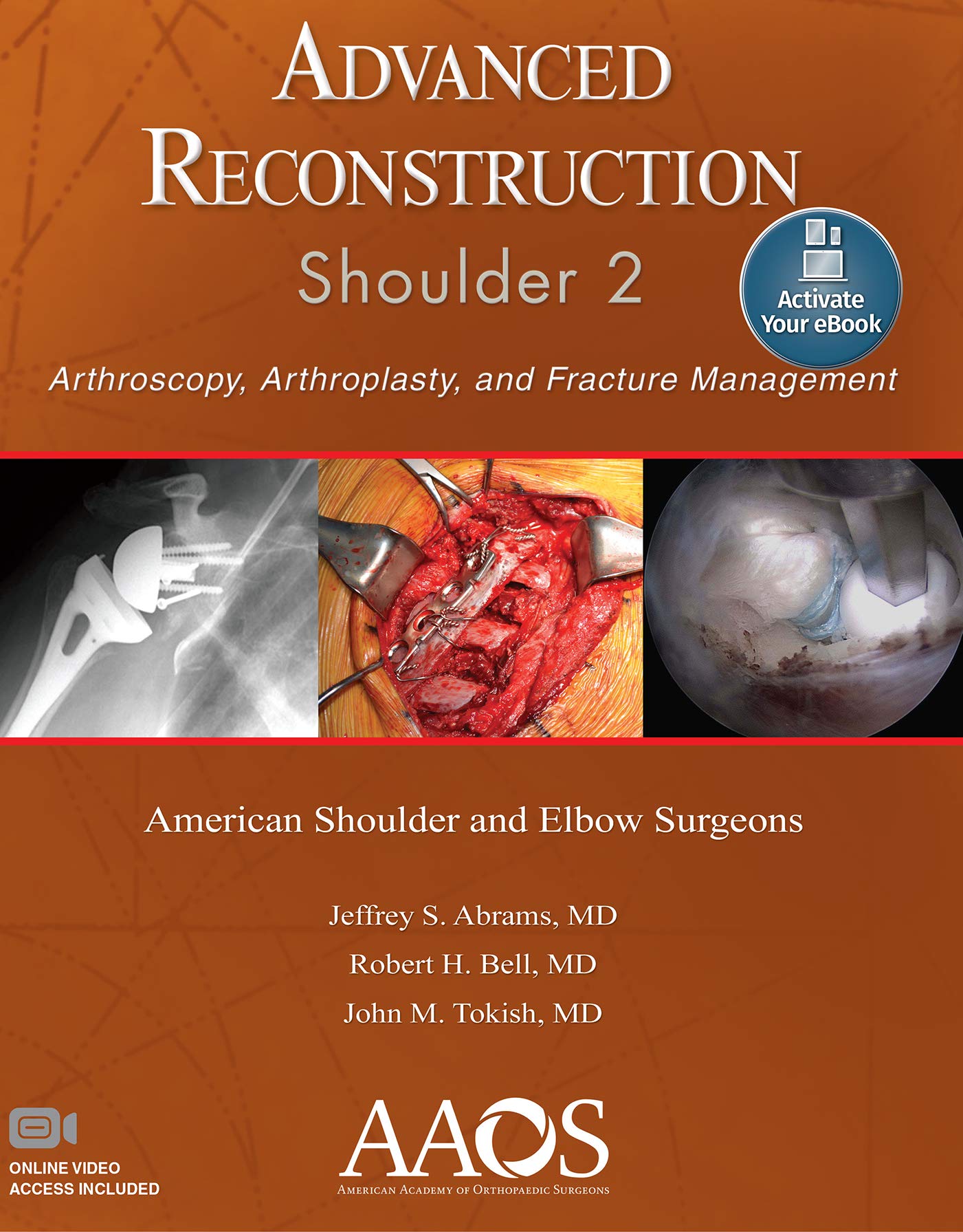ADVANCED RECONSTRUCTION SHOULDER 2 ARTHROSCOPY ARTHROPLASTY AND FRACTURE MANAGEMENT (PB 2016)