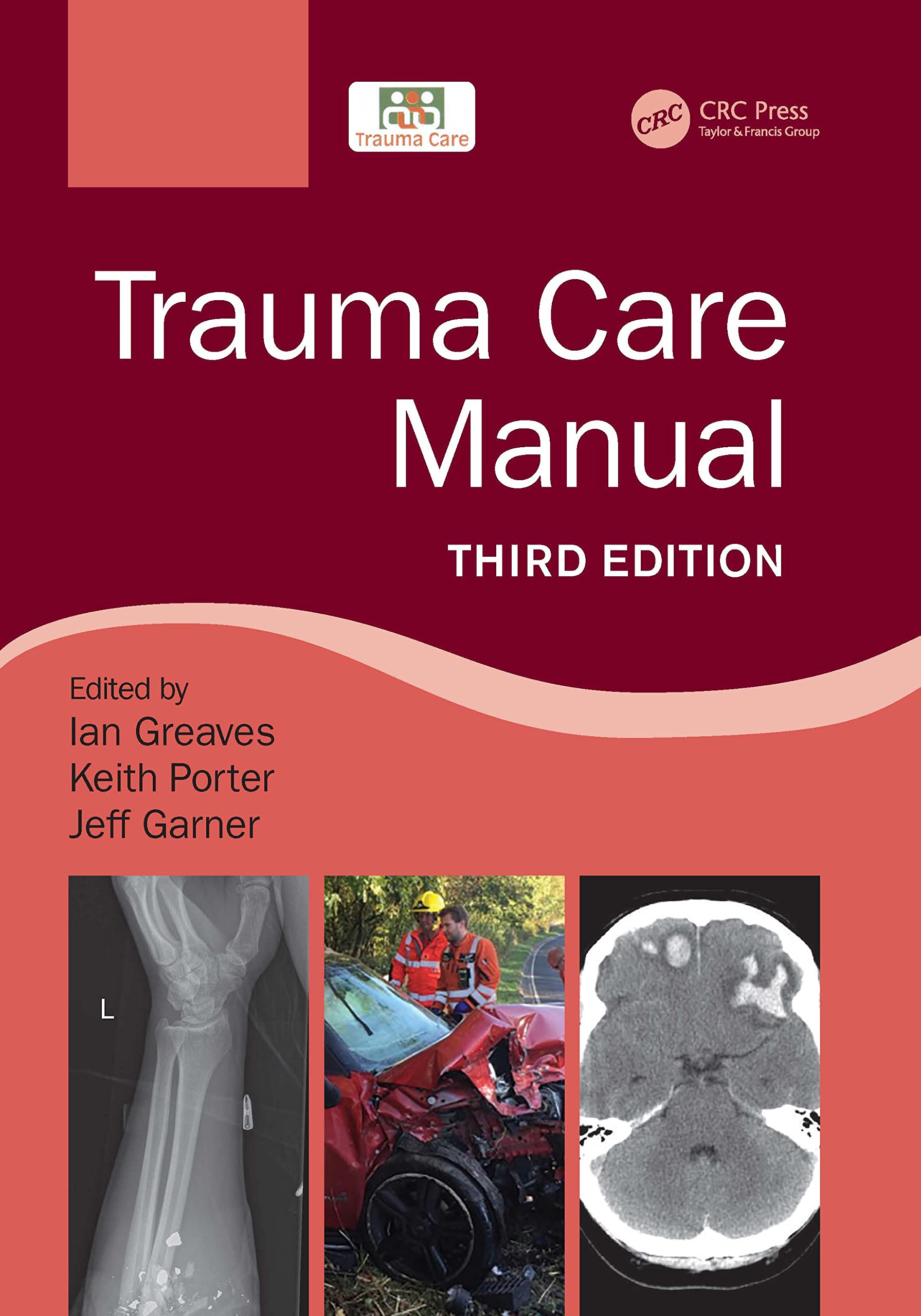 Trauma Care Manual 3Ed (Pb 2022)