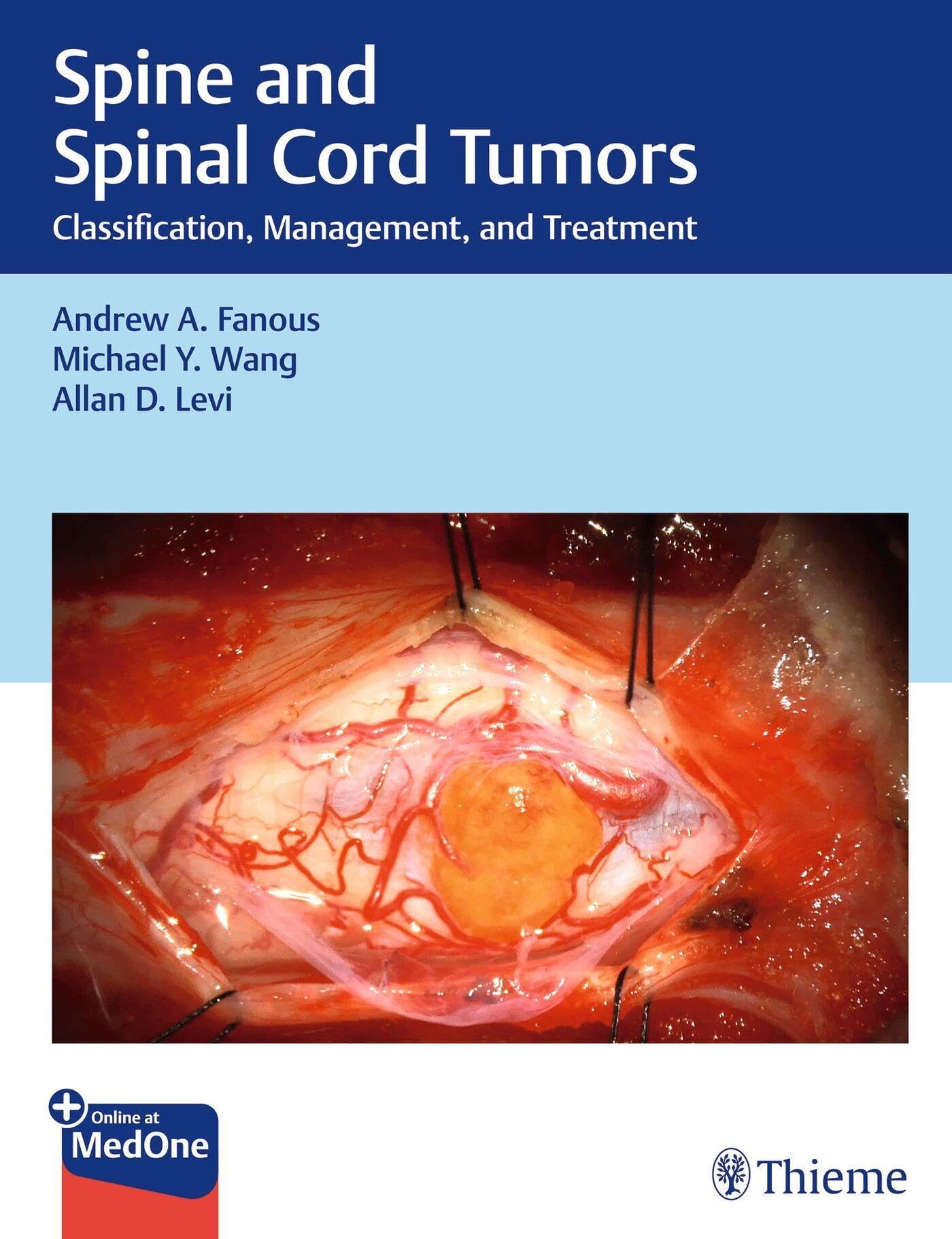 SPINE AND SPINAL CORD TUMORS CLASSIFICATION MANAGEMENT AND TREATMENT WITH ACCESS CODE (HB 2025)