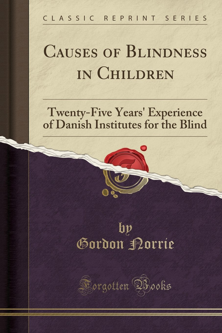 Causes of Blindness in Children: TwentyFive Years Experience of Danish Institutes for the Blind (Classic Reprint)