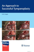 An Approach To Successful Tympanoplasty With Access Code (Hb 2024)