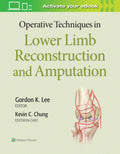 OPERATIVE TECHNIQUES IN LOWER LIMB RECONSTRUCTION AND AMPUTATION (HB 2020)
