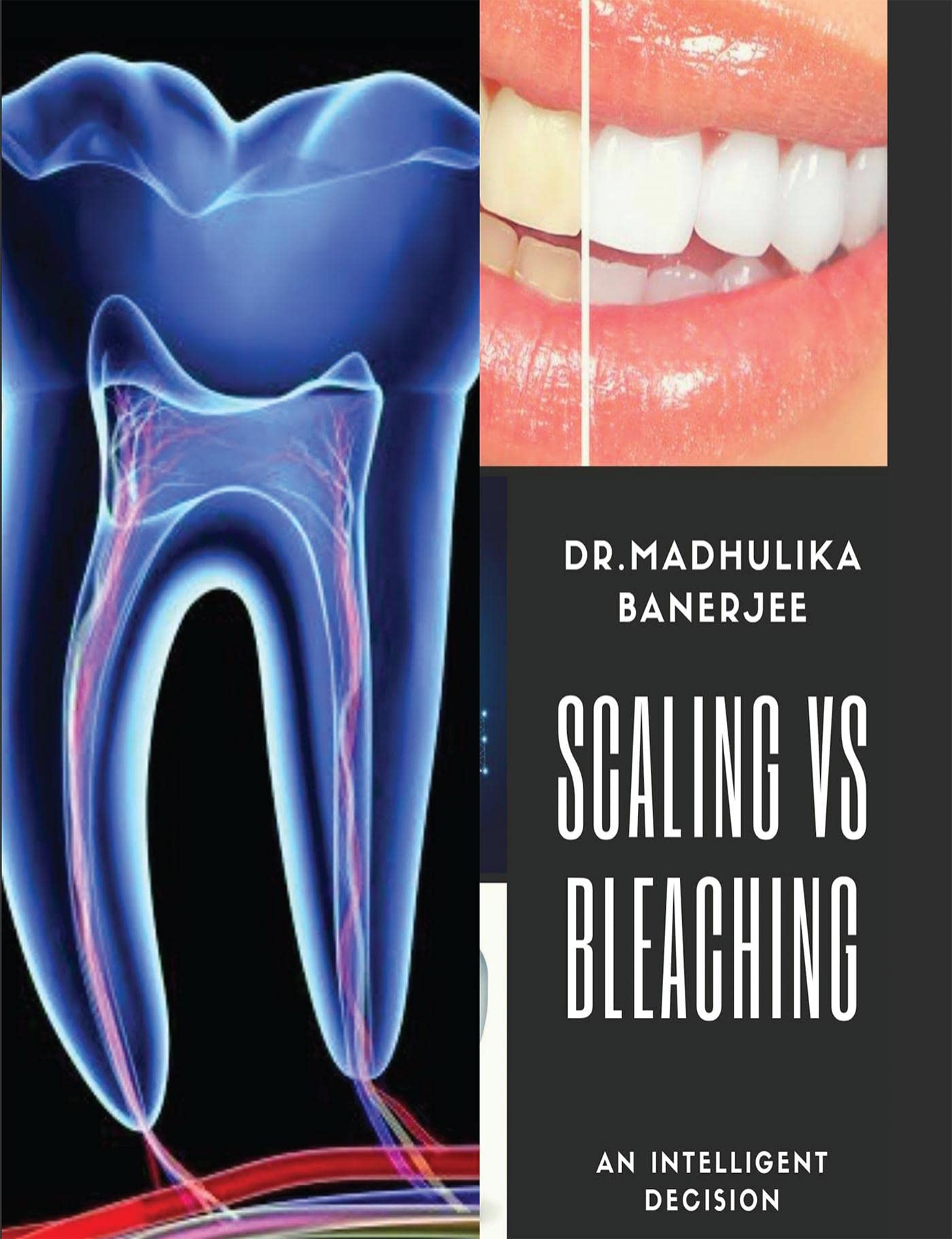Scaling Vs Bleaching : An Intelligent Decision