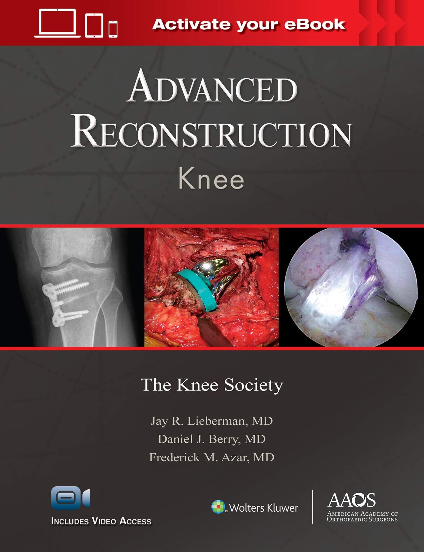 Advanced Reconstruction: Knee: Print + Ebook With Multimedia (Aaos  American Academy Of Orthopaedic Surgeons)