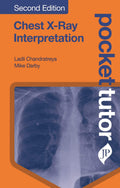 Chest XRay Interpretation (Pocket Tutor) (POD): Second Edition
