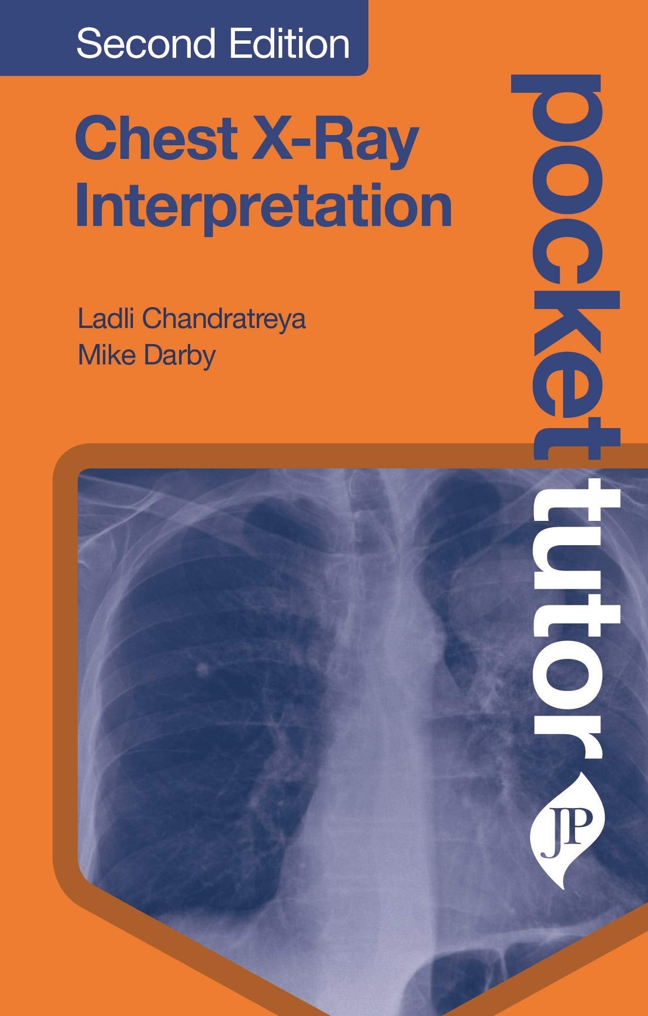 Chest XRay Interpretation (Pocket Tutor) (POD): Second Edition