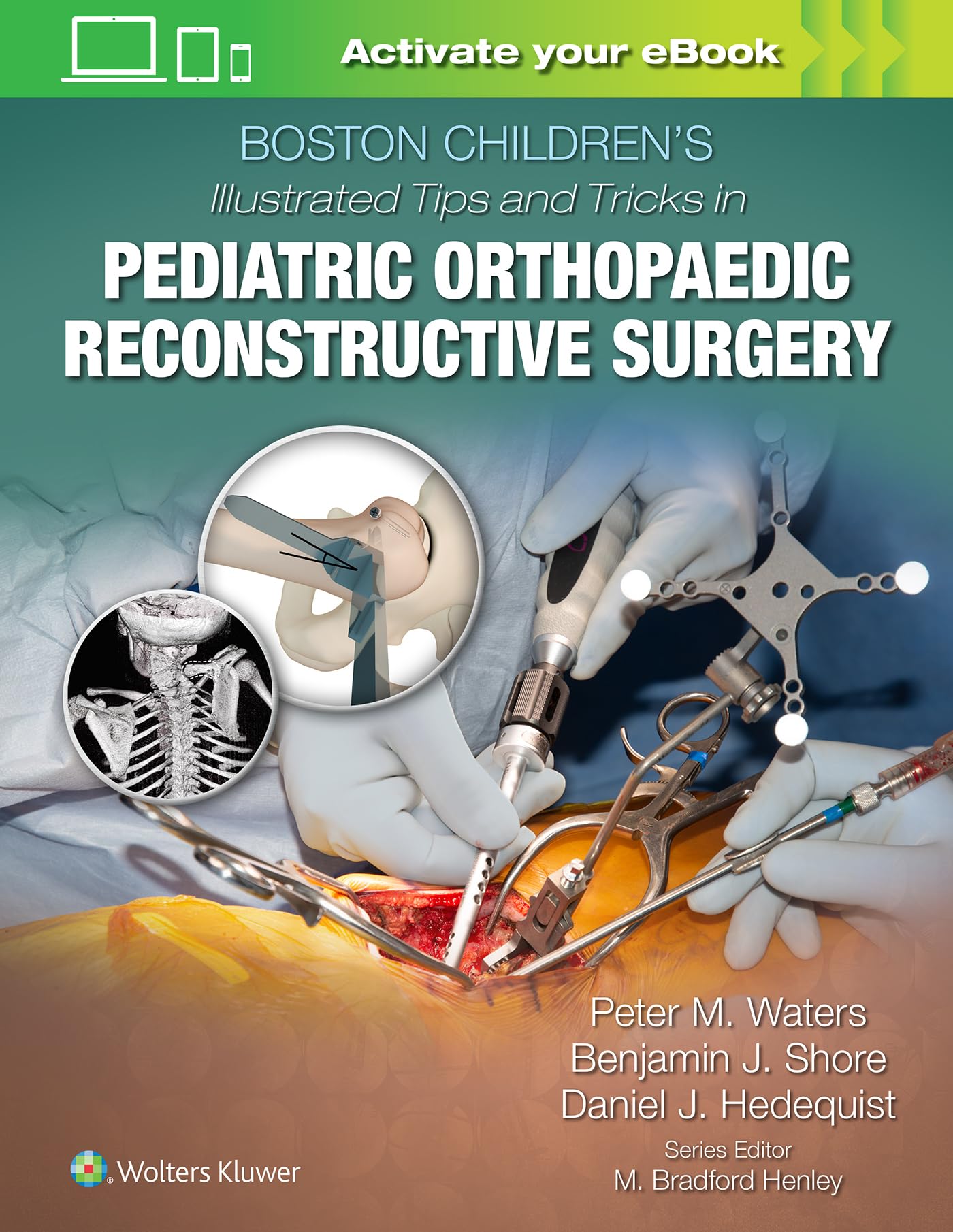 BOSTON CHILDRENS ILLUSTRATED TIPS AND TRICKS IN PEDIATRIC ORTHOPAEDIC RECONSTRUCTIVE SURGERY (HB 2022)
