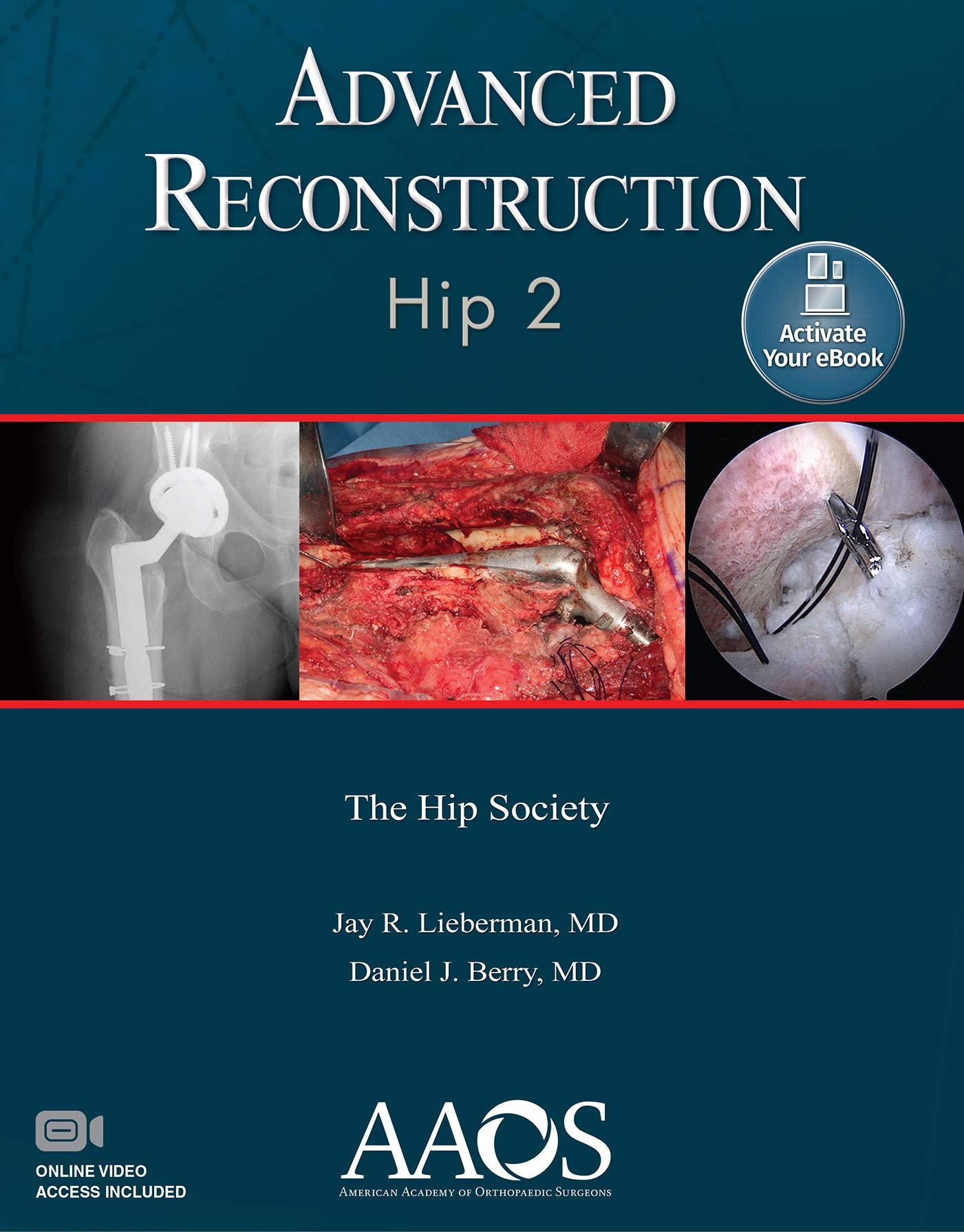 Advanced Reconstruction: Hip 2: Print + Ebook with Multimedia (AAOS  American Academy of Orthopaedic Surgeons)