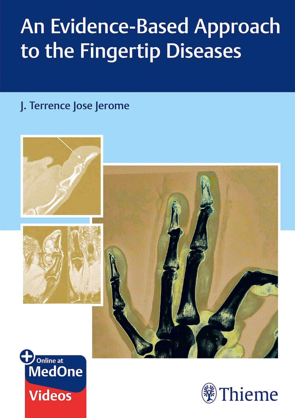 An Evidencebased Approach to the Fingertip Diseases
