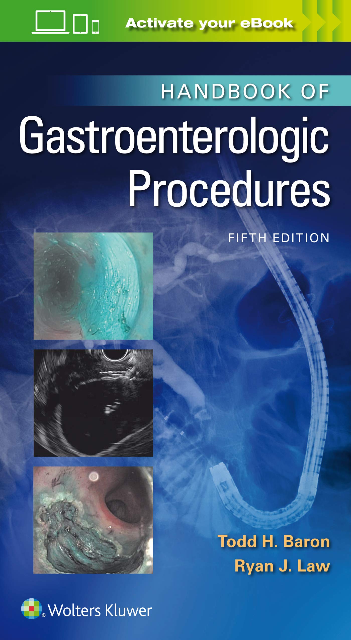 Handbook Of Gastroenterologic Procedures 5Ed (Pb 2021) (Lippincott Williams And Wilkins Handbook Series)