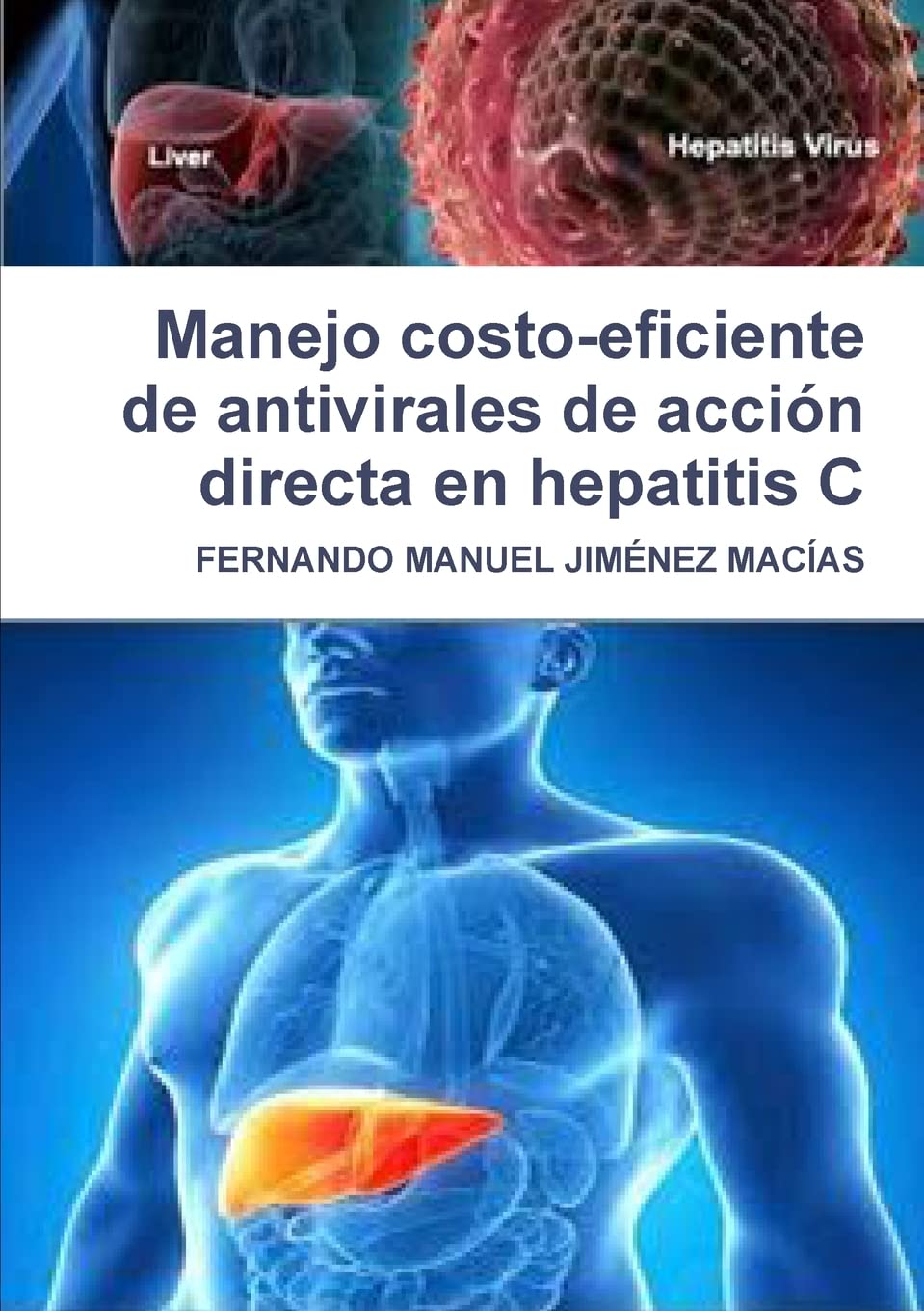Manejo CostoEficiente De Antivirales De Accion Directa En Hepatitis C