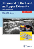 Ultrasound of the Hand and Upper Extremity: A StepbyStep Guide
