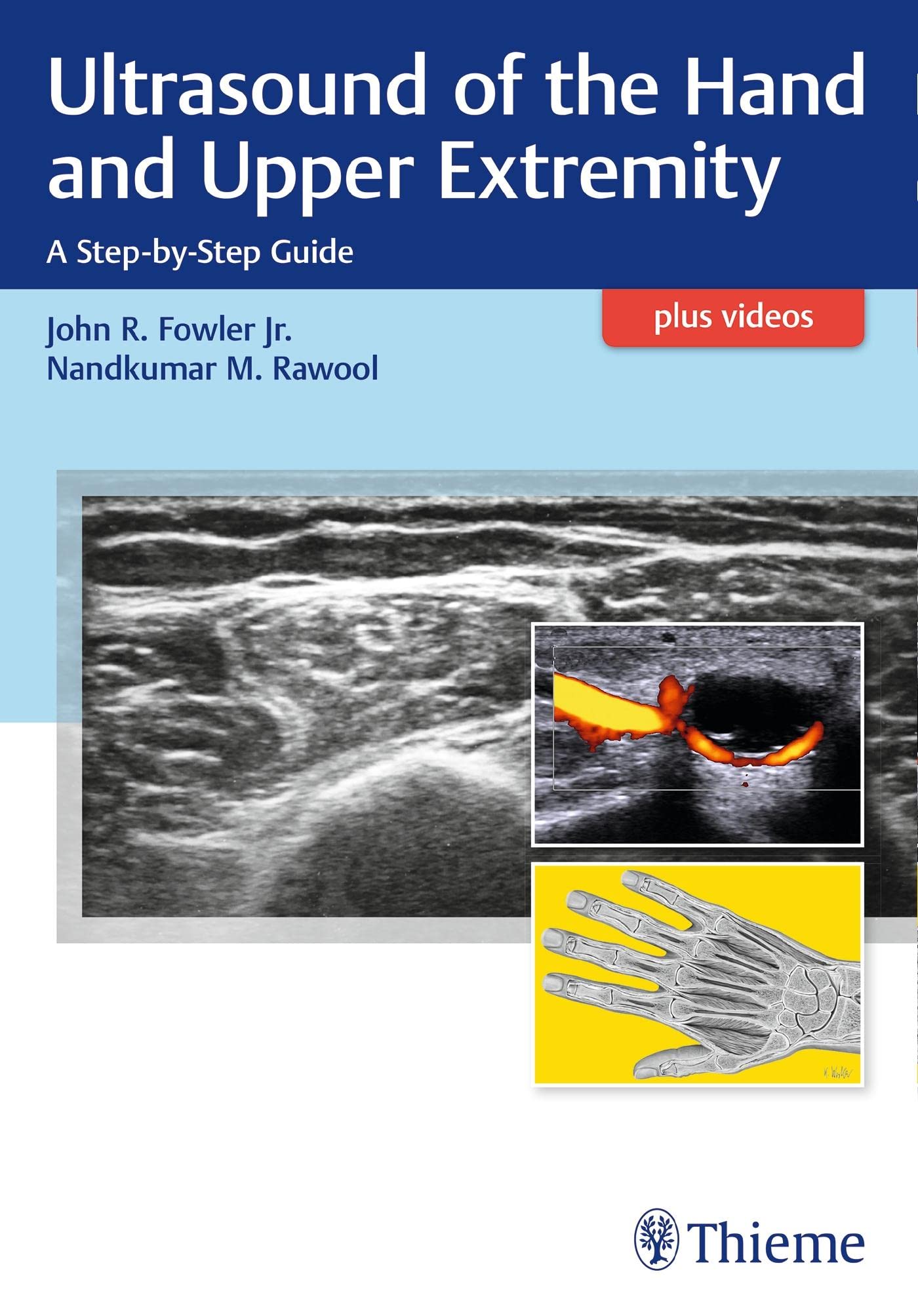 Ultrasound of the Hand and Upper Extremity: A StepbyStep Guide