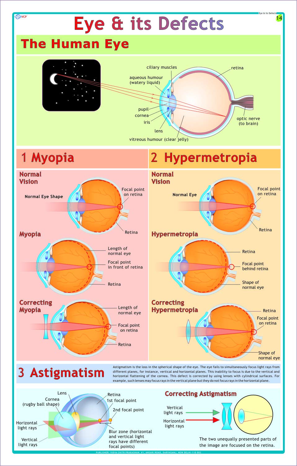 Eye & its Defects ( Myopia, Hypermetropia & Astigmatism )
