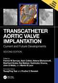 Transcatheter Aortic Valve Implantation: Current And Future Developments