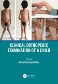 CLINICAL ORTHOPEDIC EXAMINATION OF A CHILD (PB 2021)