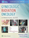 Gynecologic Radiation Oncology A Practical Guide
