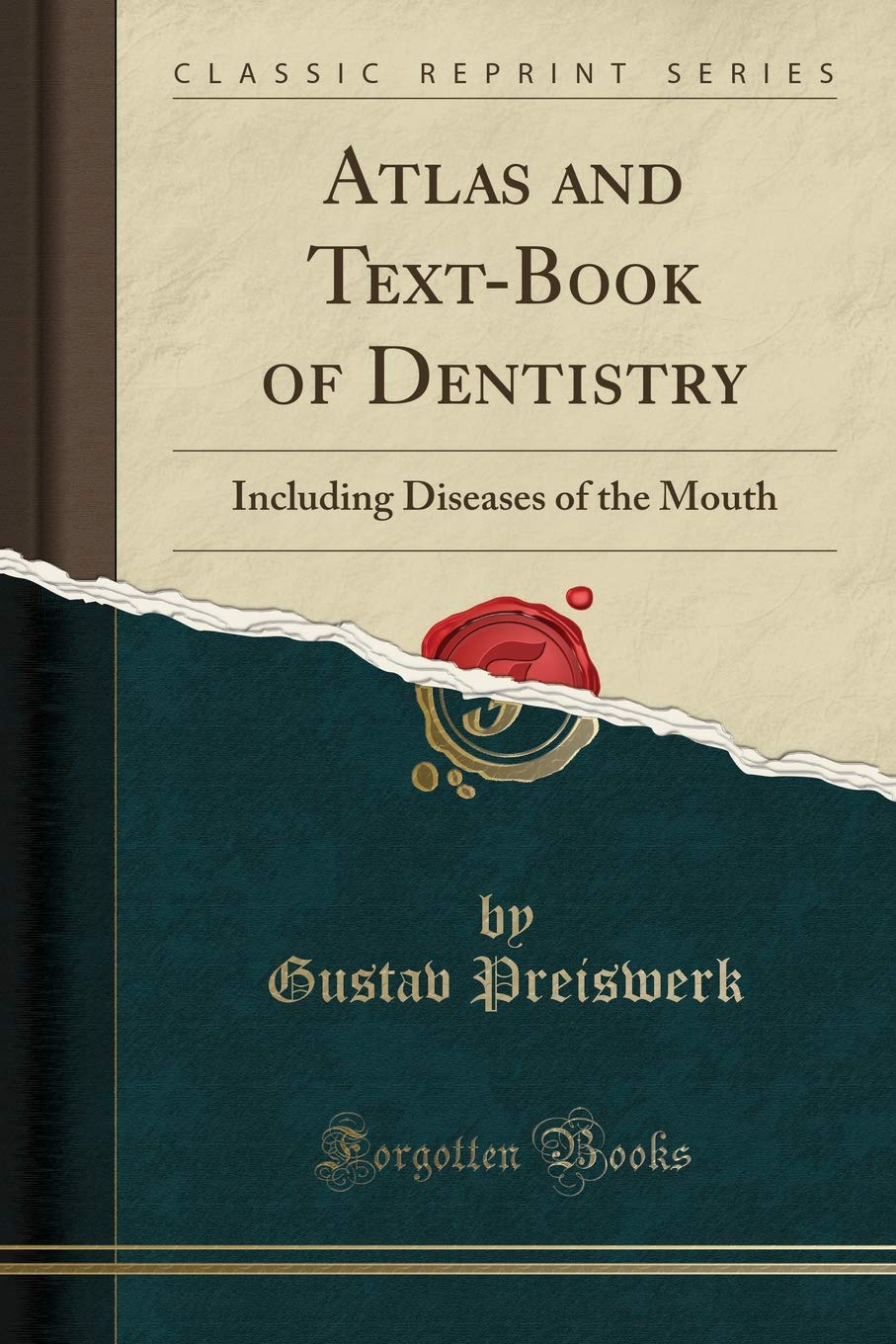 Atlas and TextBook of Dentistry: Including Diseases of the Mouth (Classic Reprint)