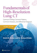 Fundamentals of HighResolution Lung CT: Common Findings, Common Patterns, Common Diseases and Differential Diagnosis