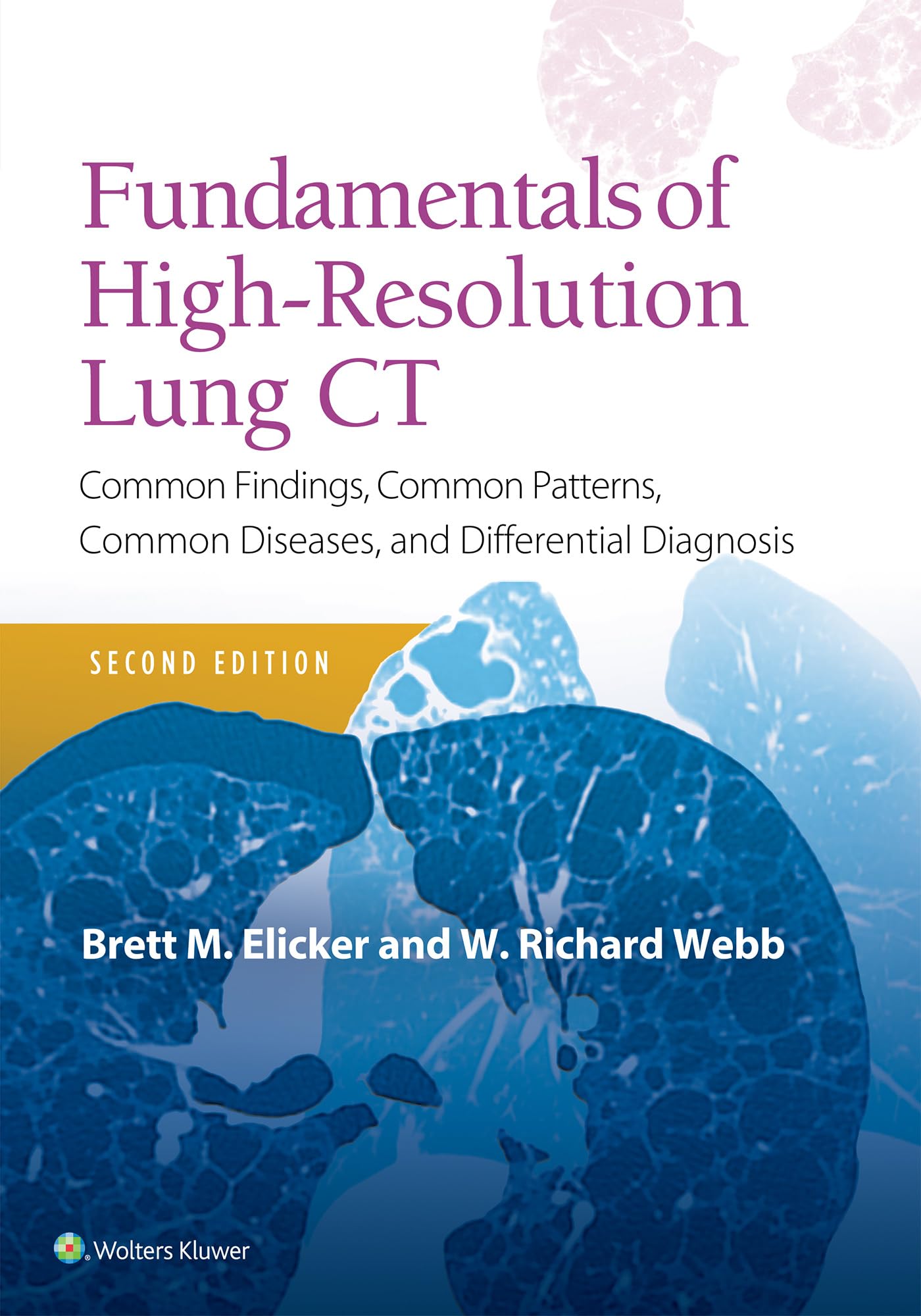 Fundamentals of HighResolution Lung CT: Common Findings, Common Patterns, Common Diseases and Differential Diagnosis