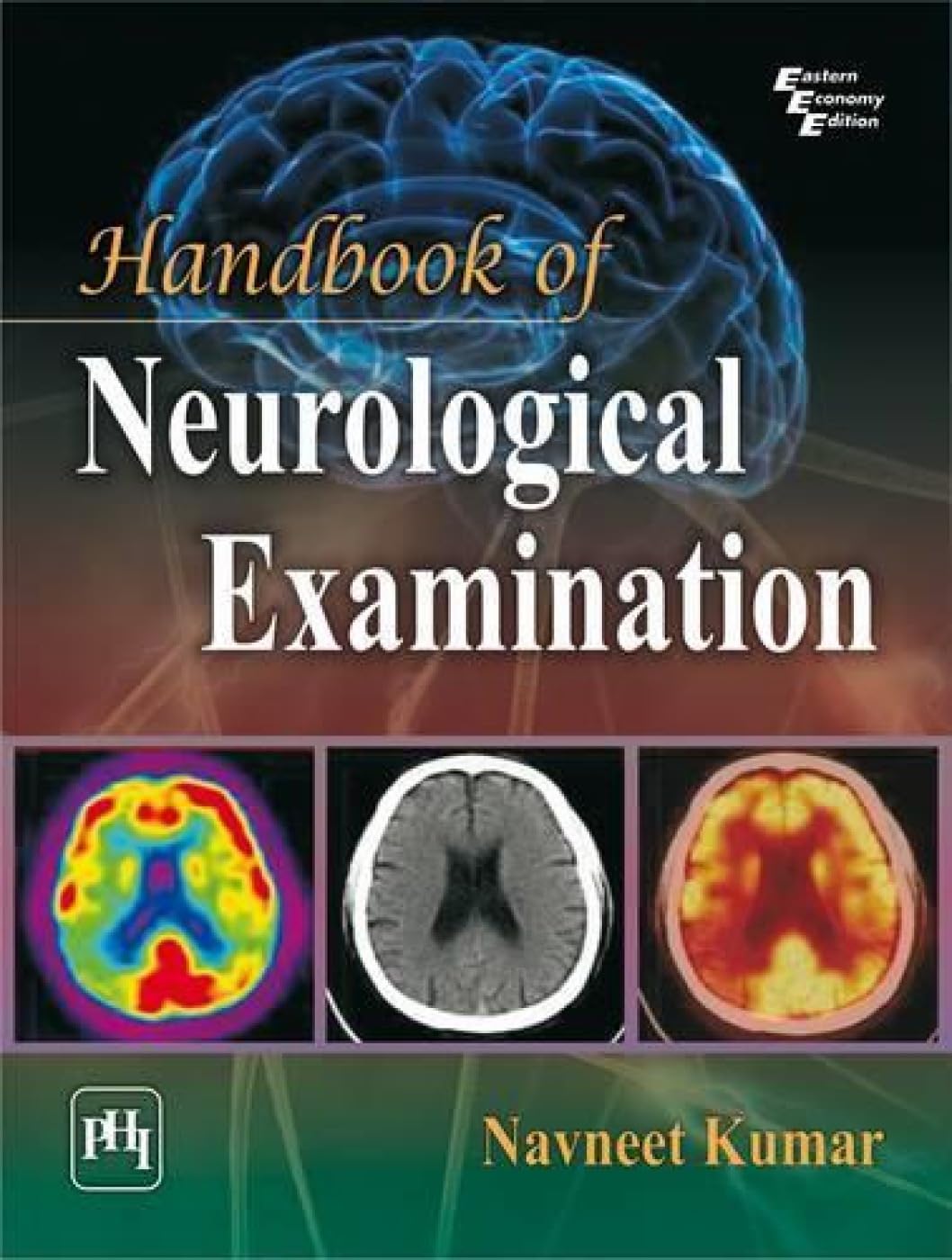 Handbook of Neurological Examination