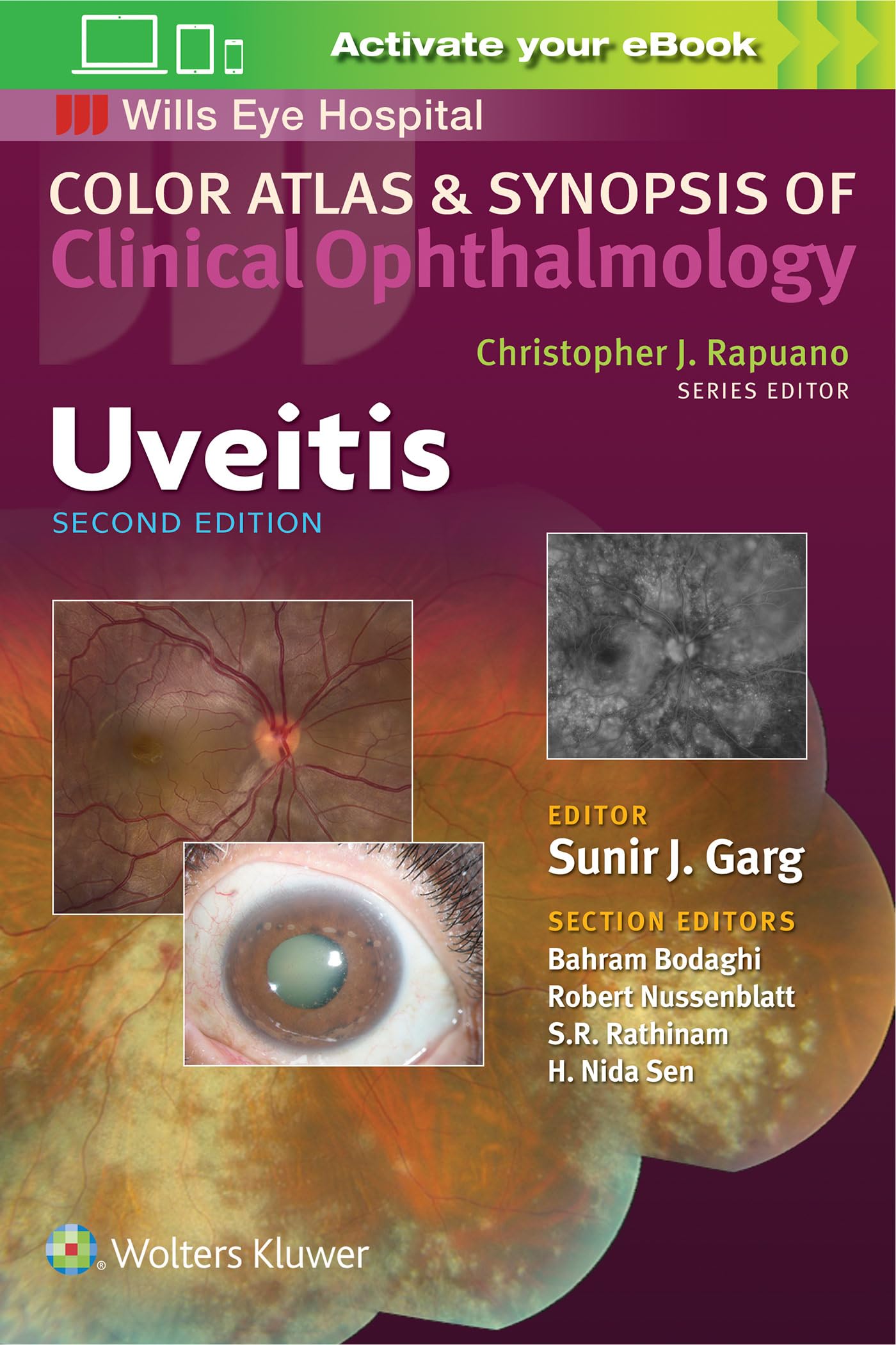 Uveitis (Color Atlas & Synopsis Of Clinical Ophthalmology)
