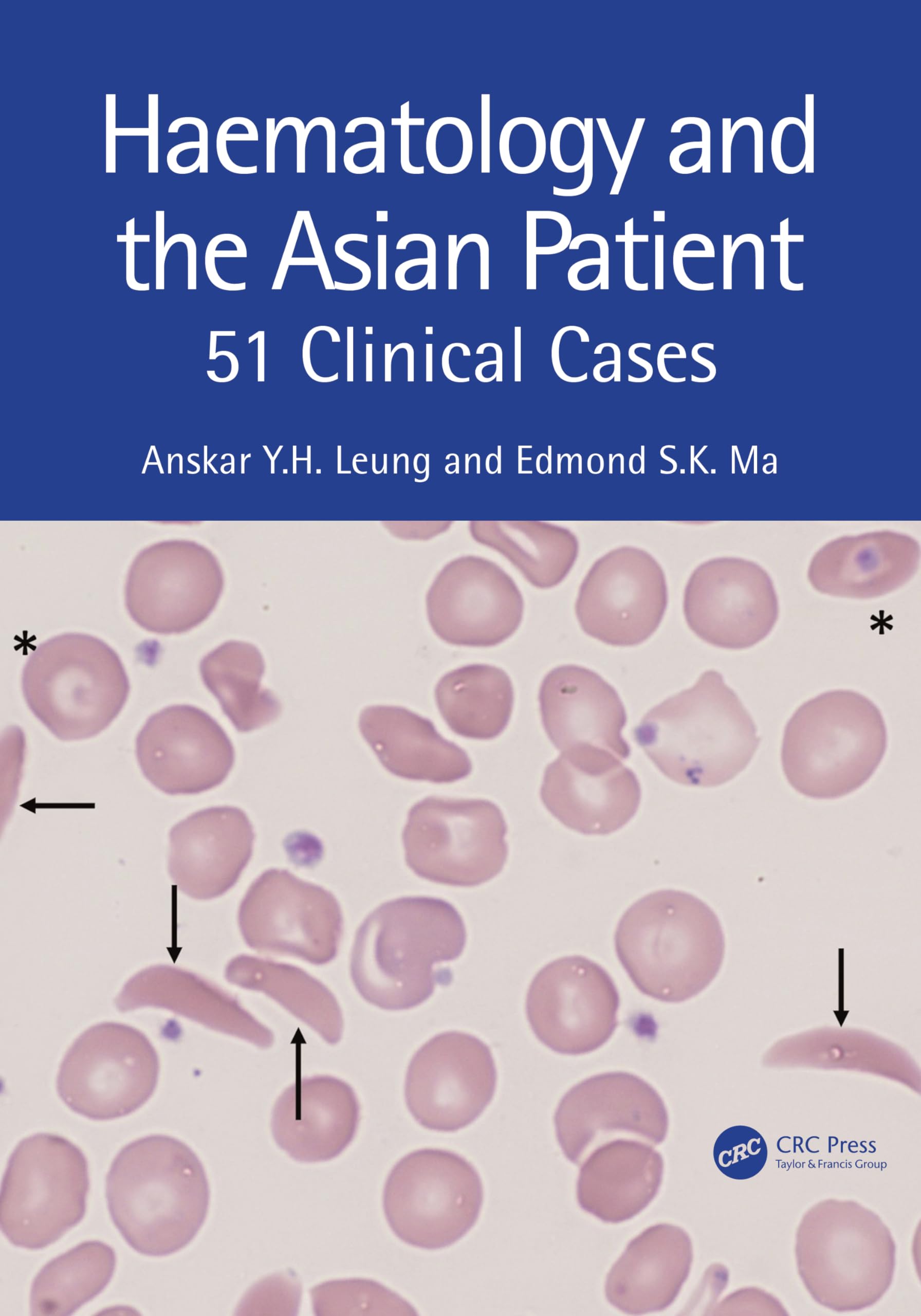 Haematology and the Asian Patient: 51 Clinical Cases