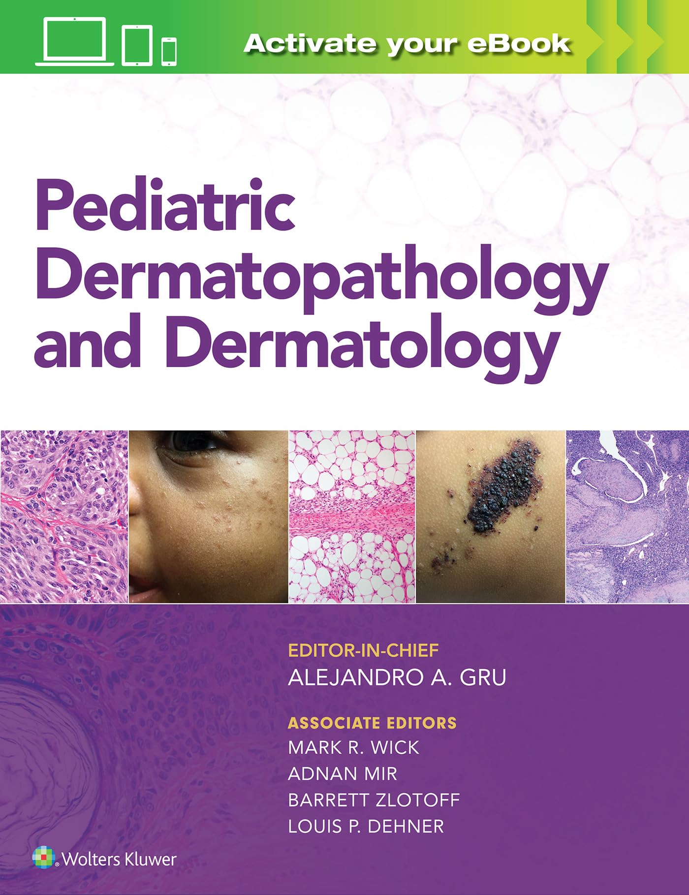 Pediatric Dermatopathology And Dermatology (Hb 2019)