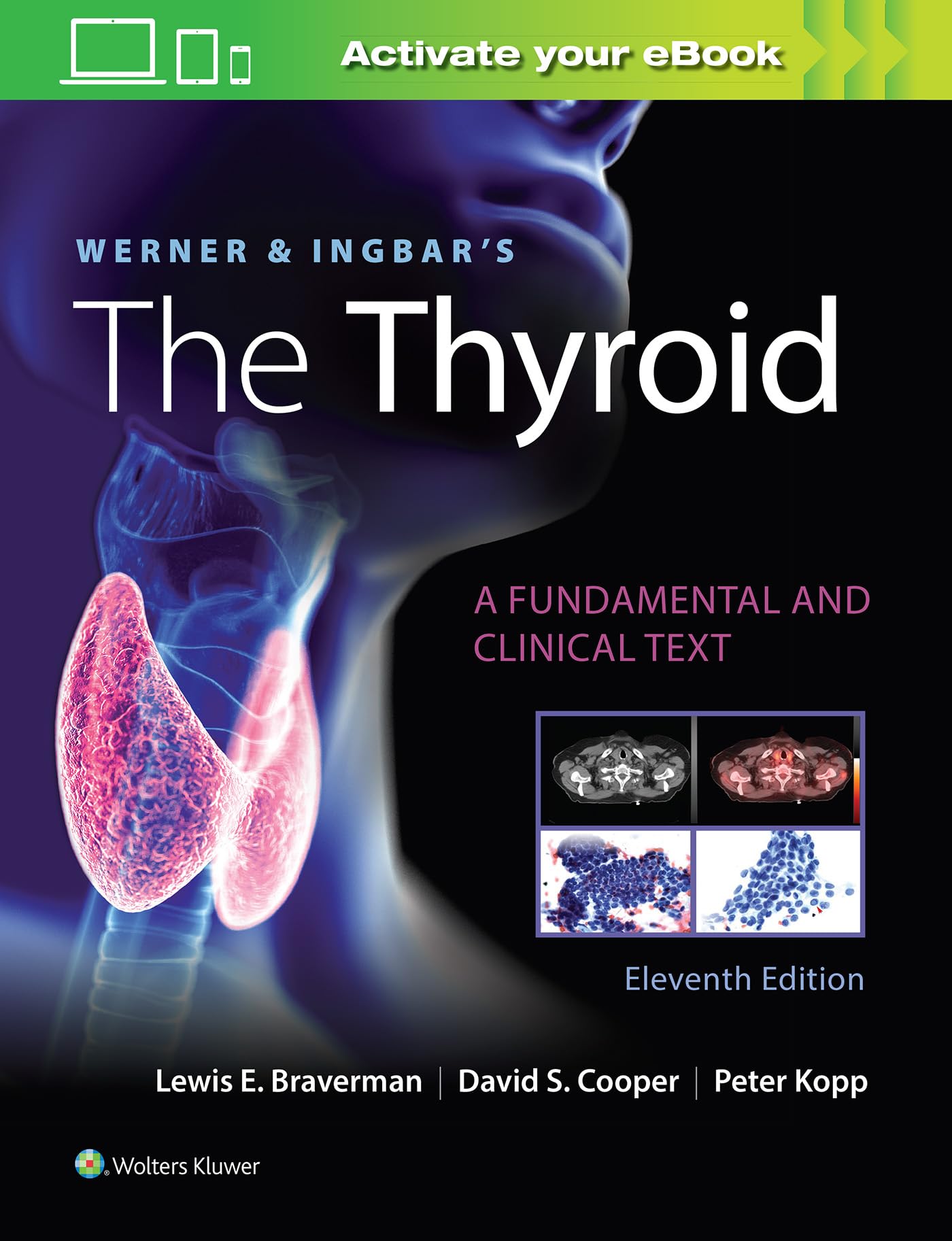 Werner & Ingbars The Thyroid (Werner and Ingbars the Thyroid)