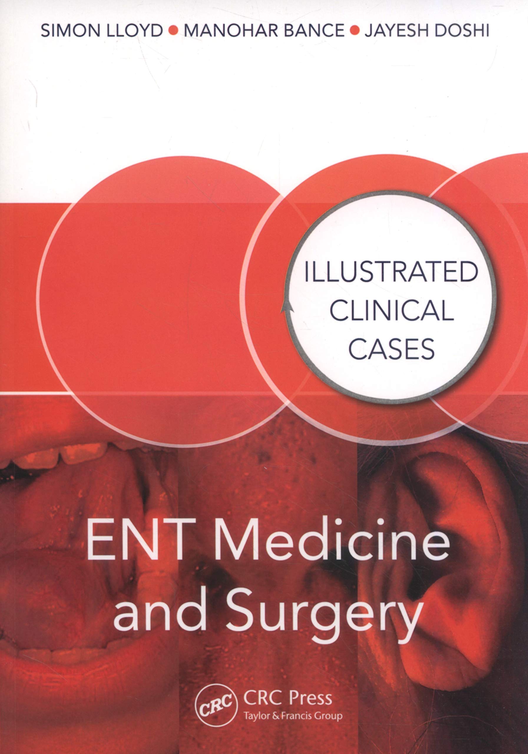 Ent Medicine And Surgery: Illustrated Clinical Cases (Excl. Abc)