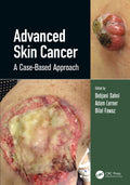 ADVANCED SKIN CANCER A CASE BASED APPROACH (HB 2022)