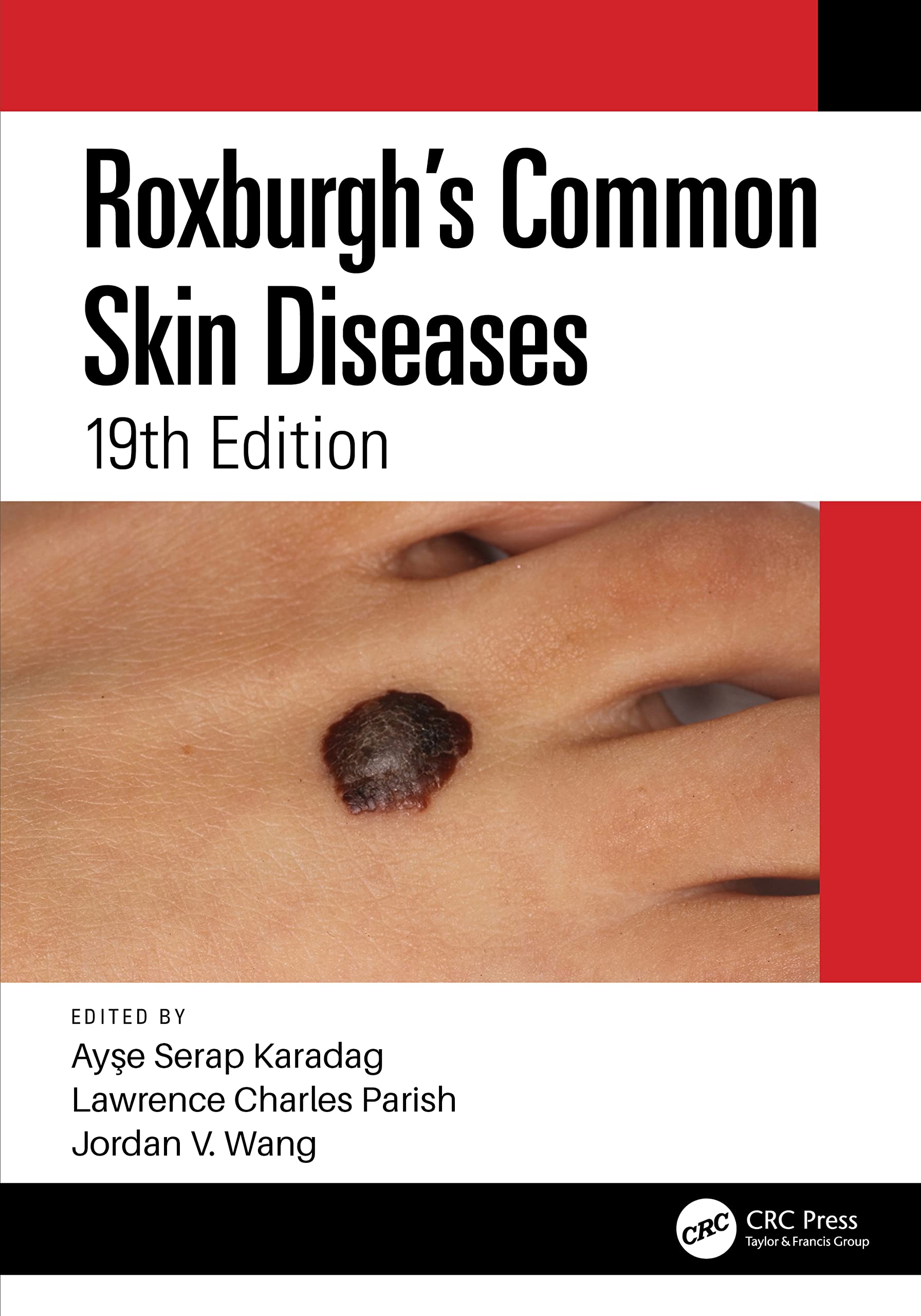 Roxburghs Common Skin Diseases 19Ed (Pb 2022)