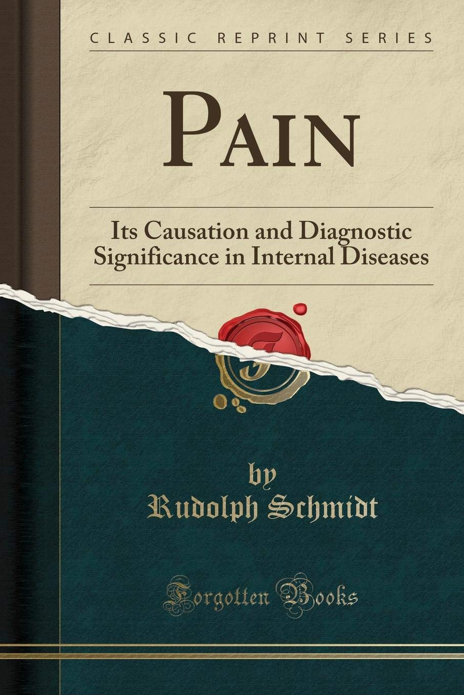 Pain: Its Causation and Diagnostic Significance in Internal Diseases (Classic Reprint)