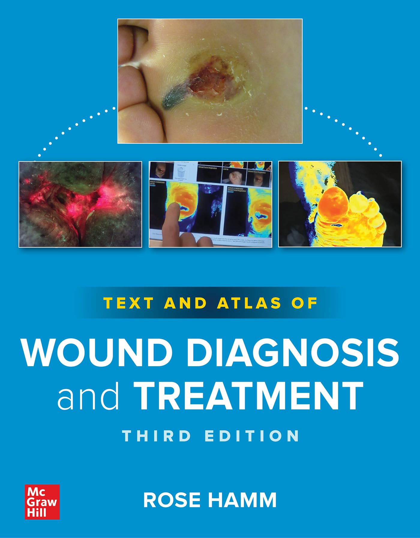 TEXT AND ATLAS OF WOUND DIAGNOSIS AND TREATMENT 3ED (PB 2024)