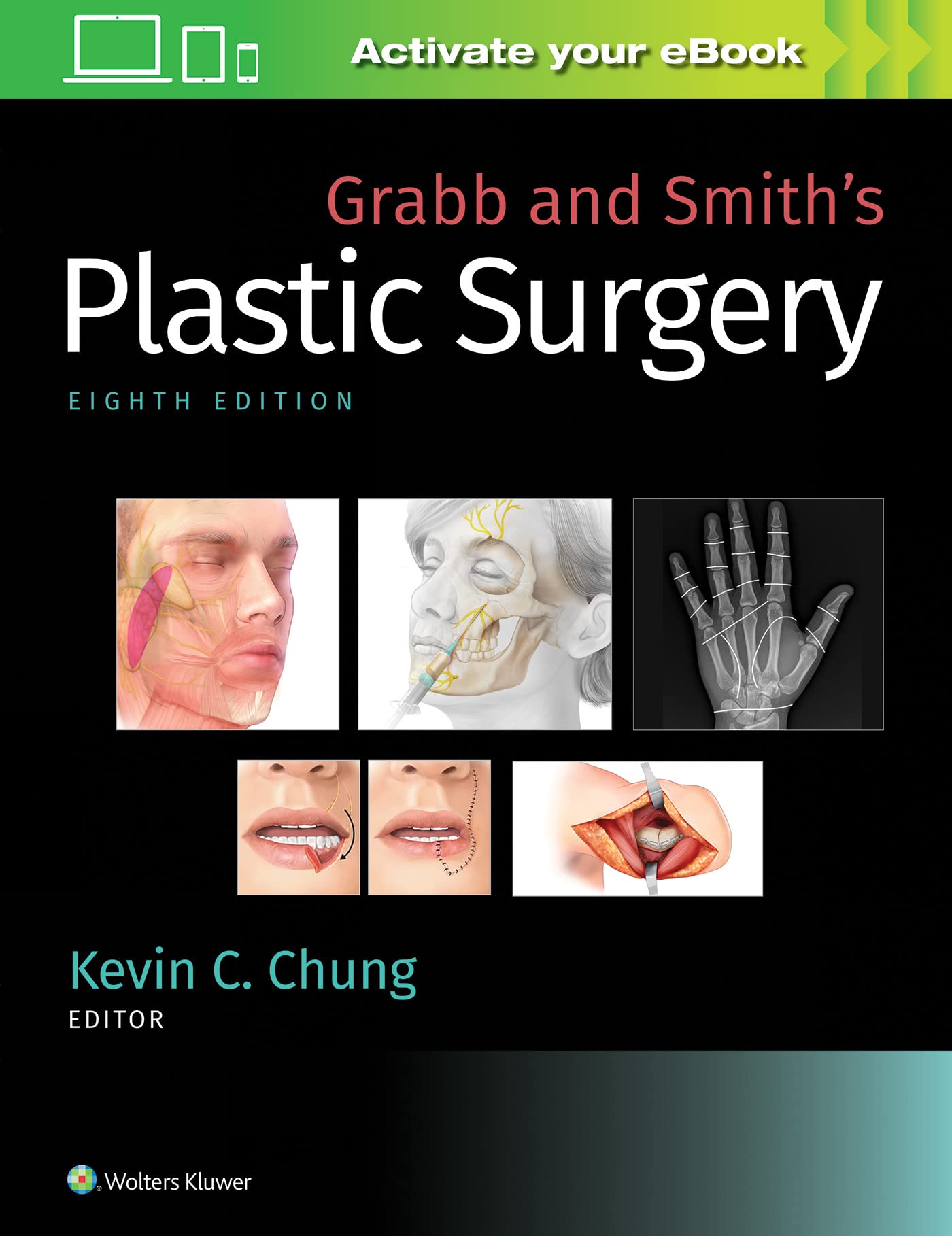 Grabb and Smiths Plastic Surgery