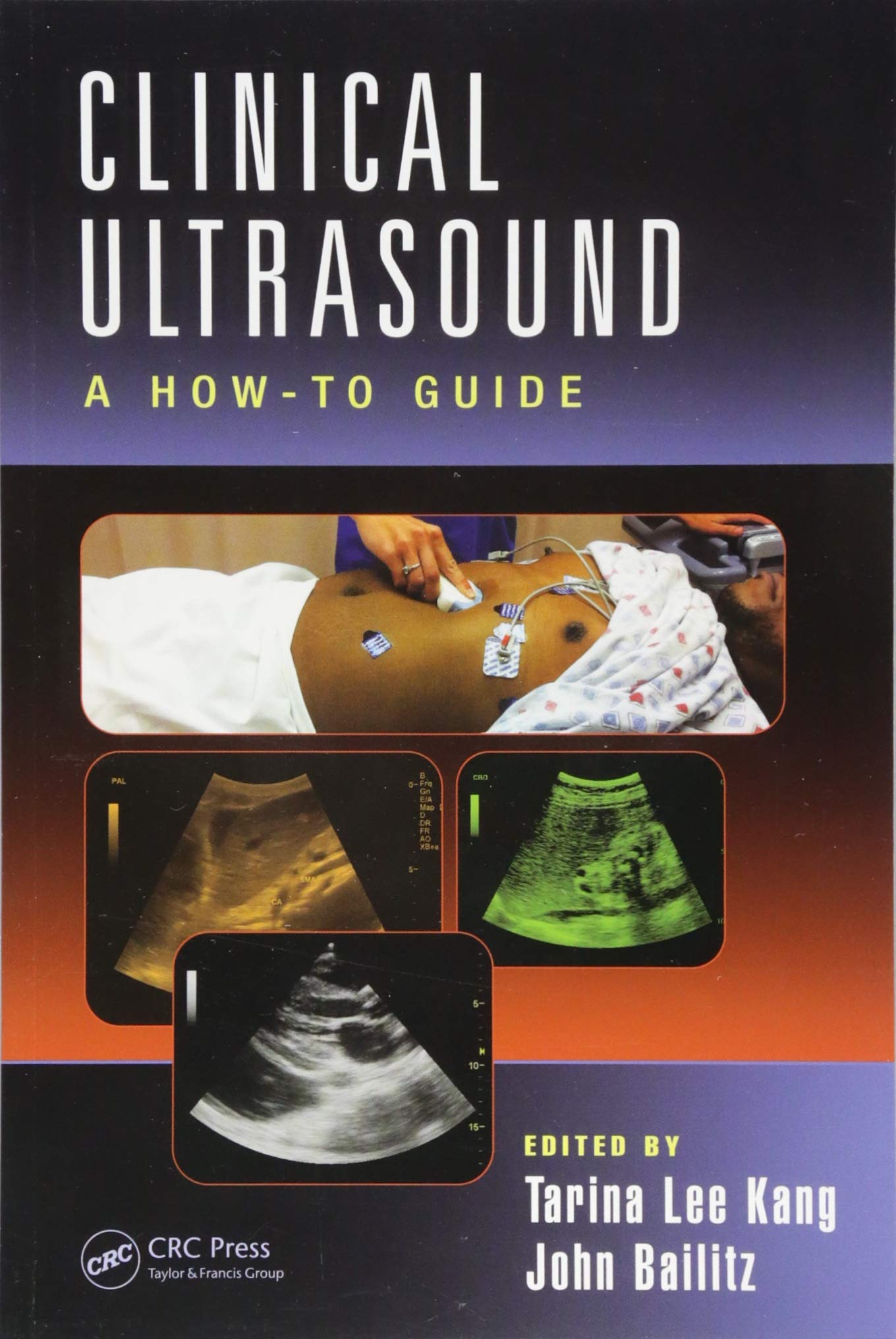 Clinical Ultrasound A How To Guide (Pb 2015)