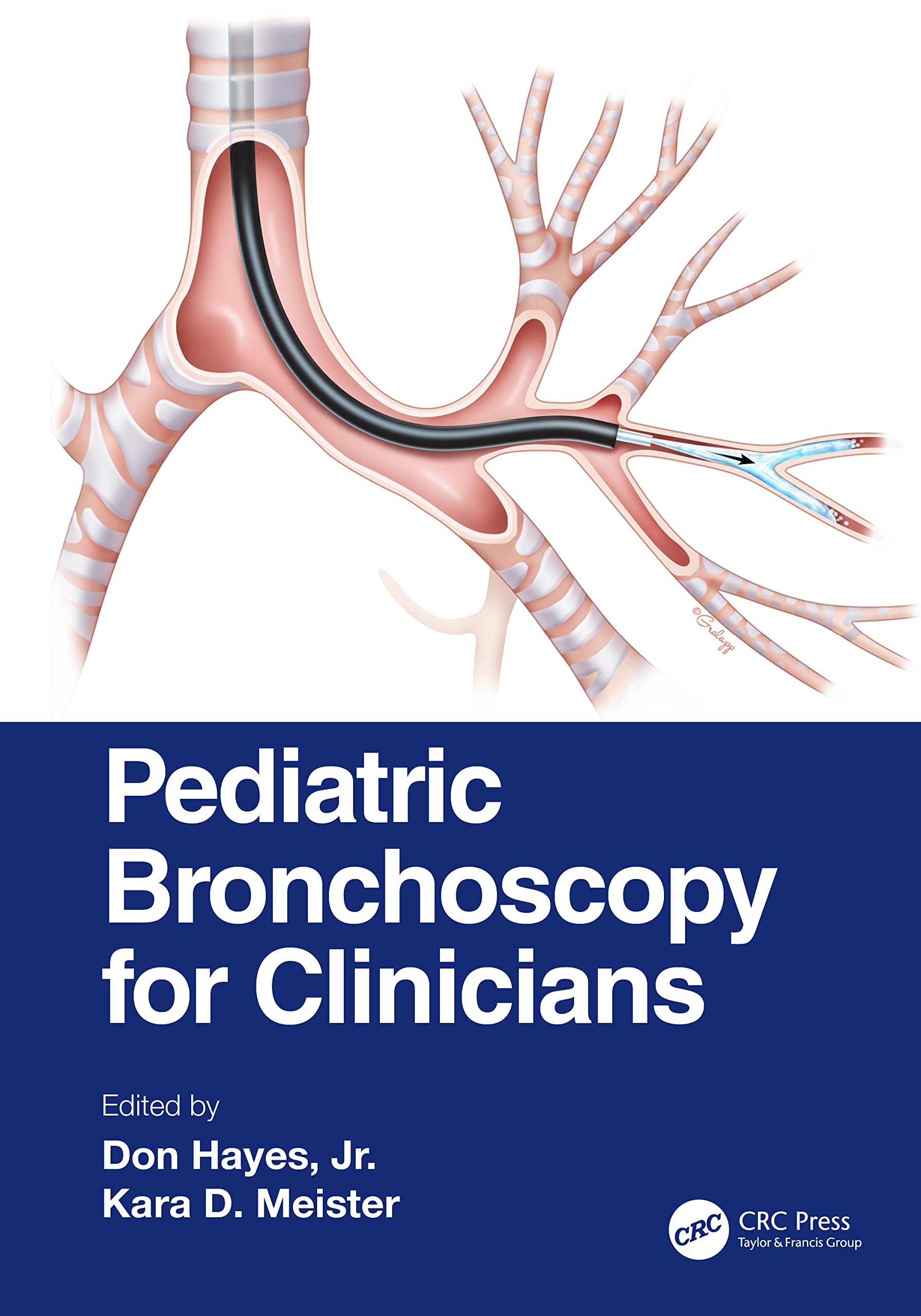 PEDIATRIC BRONCHOSCOPY FOR CLINICIANS (PB 2023)